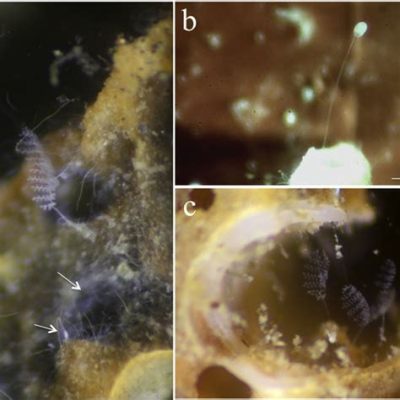   Zoom into the Microscopic World: Zoothamnium – a Colonial Ciliate With Tentacles Like Spaghetti!