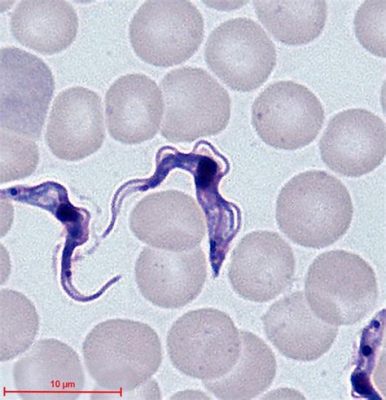  Trypanosoma! A Single-Celled Wonder That Navigates Bloodstream Highways