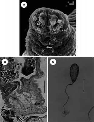  Ulcer-Causing Udonella: Discover the Tiny Worm That Lives in Your Fish!